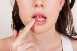 أسباب وأعراض وعلاج تقرحات الفم