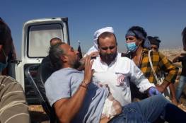 اصابات واعتقالات خلال مسيرة في المفقرة شرق يطا