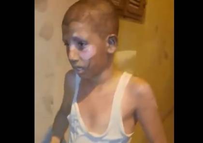 متطرفون يحرقون منزلا في يافا وإصابة طفلين (فيديو)