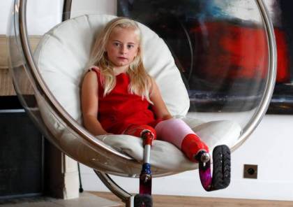 طفلة مبتورة ساقين "تصنع التاريخ" في عالم الموضة