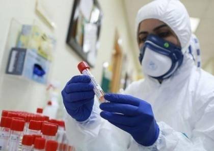 الصحة العالمية: قد لا يكون هناك حل لأزمة فيروس كورونا إطلاقاً