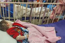 تناولت سم فئران.. إنقاذ رضيعة من الموت في مستشفى الشهيد ياسر عرفات الحكومي
