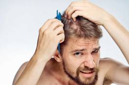 5 عوامل رئيسية تسبب تساقط الشعر!