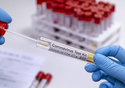 تسجيل 72 إصابة جديدة بفيروس كورونا في صفوف جالياتنا بالعالم