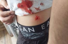 فيديو: إصابة شاب برصاص مستوطن في حي الشيخ جراح بالقدس المحتلة