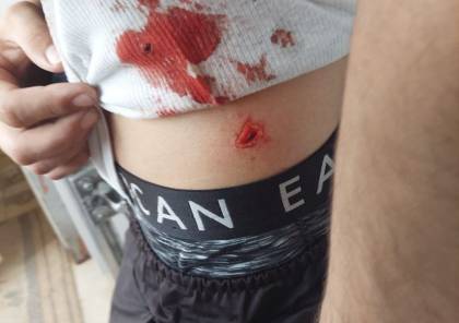 فيديو: إصابة شاب برصاص مستوطن في حي الشيخ جراح بالقدس المحتلة