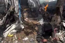 الاحتلال يرتكب مجزرة باستهداف خيام النازحين بساحة مستشفى شهداء الأقصى
