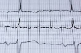 أي جزء من الجسم قد يتألم أثناء النوبة القلبية ؟