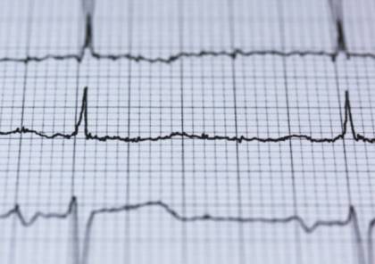 أي جزء من الجسم قد يتألم أثناء النوبة القلبية ؟