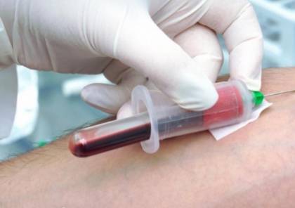 فحص للدم يكشف ألزهايمر قبل 20 عاما من الإصابة به