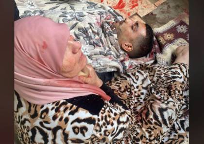  14شهيدا في مجزرة ارتكبها الاحتلال في مخيم نور شمس