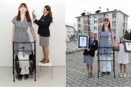 تركية تدخل غينيس كونها أطول امرأة على قيد الحياة في العالم (فيديو وصور)