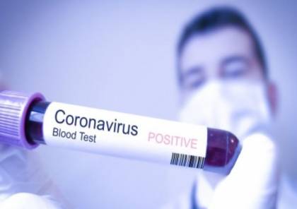 الموافقة على استخدام علاج محتمل لفيروس كورونا في إسرائيل