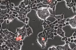 شاهد بالفيديو لأول مرة: تصوير غزو فيروس كورونا لخلايا الدماغ