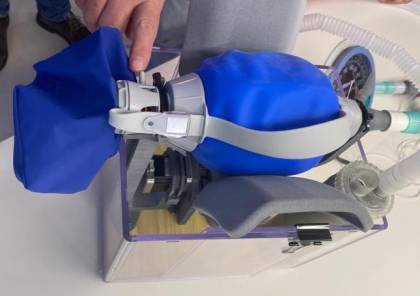 إنتاج جهاز تنفس اصطناعي رخيص التكلفة باستخدام الطباعة ثلاثية الأبعاد