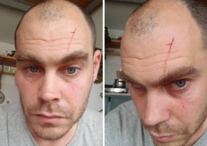 صورة أرشيفية لاعتداء مستوطنين على بولاك عام 2019