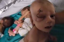 صحة غزة تنفي توصلها إلى اتفاق مع الاحتلال حول الأطفال الخدج في مستشفى الشفاء