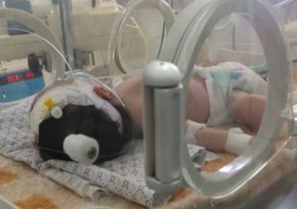  وفاة رضيعة من غزة جراء تأخر تحويلتها الطبية