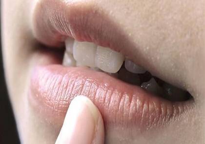 4 علاجات منزلية لإزالة الجلد الداكن حول الفم