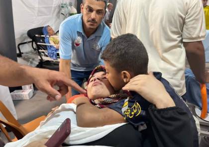 الصحة بغزة: 31 شهيدًا و284 إصابة بجراح مختلفة جراء العدوان الإسرائيلي