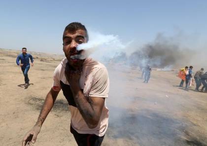 الأردن يتكفل بعلاج مصاب "قنبلة الغاز" هيثم أبو سيلة من غزة