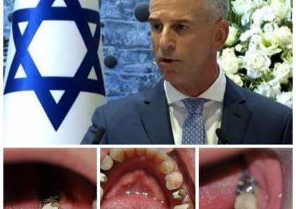 إعلام إسرائيلي: قراصنة إيرانيون اخترقوا هاتف رئيس "الموساد" ونشروا صورًا لأسنانه