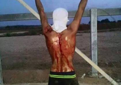 اصابة فتى بجراح خطيرة برصاص الاحتلال شرق البريج وسط قطاع غزة 