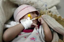 ارتفاع وفيات الكوليرا باليمن إلى 942 وعدد المصابين تجاوز 124 ألفاً