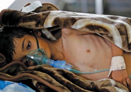 الصحة العالمية: الكوليرا يقضي على 1500 مواطن يمني 