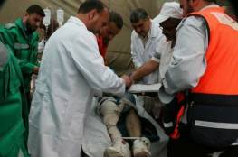 هارتس : العمليات الجراحية الخطيرة بغزة تتم بواسطة تخدير جزئي ويضطرون لبتر أطراف الجرحى 