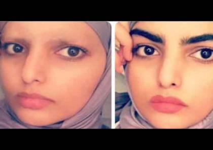 بعد تعرضها للضرب في لندن: فتاة سعودية تثير الجدل بحلاقة حاجبيها