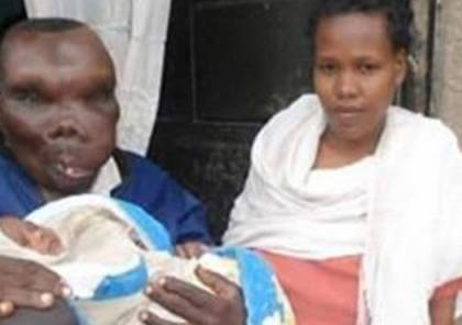 صور: "أقبح رجل في أوغندا" يتزوج مرتين وينجب 8 أطفال