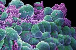 علماء يكتشفون سبب مقاومة الأورام السرطانية للأدوية