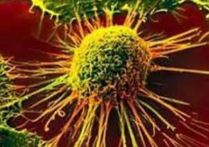 تقدم علمي مذهل :دواء جديد يقضي على السرطان ويحوله إلى مجرد مرض مزمن