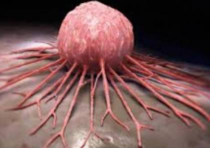 العلاج المناعي يحفز خلايا تقتل السرطان