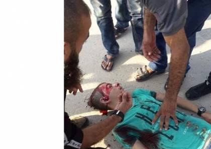 صور.. شهيدان واصابة العشرات باستهداف مبنى المكتبة الوطنية بساحة الكتيبة غرب مدينة غزة 