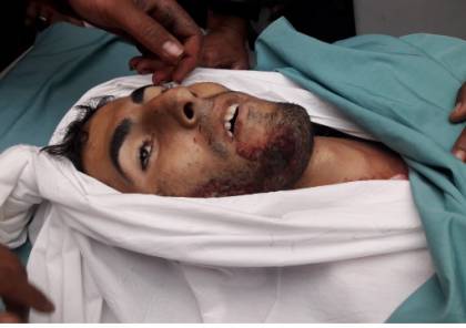 شهيدان في غزة وعشرات الاصابات في مواجهات مع جيش الاحتلال في الضفة والقدس والقطاع 