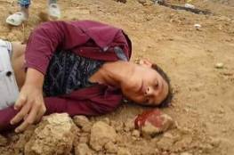 الأونروا تدعو جيش الاحتلال الاسرائيلي لوقف استهداف أطفال غزة