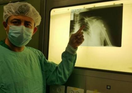 قسم الجراحة في مجمع الشفاء بغزة يجري عملية استئصال لورم نادر