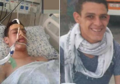 استشهاد ناجي غنيم بمستشفى بالقدس متأثرا بجراح اصيب بها قبل ايام في غزة