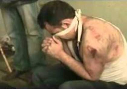 مصرع  لاجيء فلسطيني تحت التعذيب في سوريا