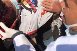 صور: اصابة طفل من "ذوي الاعاقة " برصاص الاحتلال برأسه شرق خانيونس 