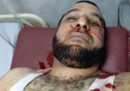 حماس: اغتيال المحرر مازن فقهاء عملية جبانة نفذها عملاء الاحتلال