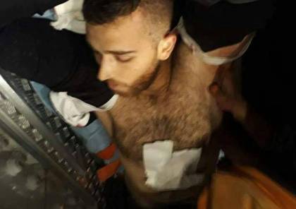 استشهاد شاب وعشرات الاصابات بينها 6 خطرة خلال المواجهات مع قوات الاحتلال في نابلس