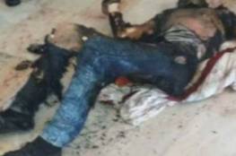 إصابة شاب بجروح خطيرة جراء محاولته الانتحار حرقا في مدينة غزة 