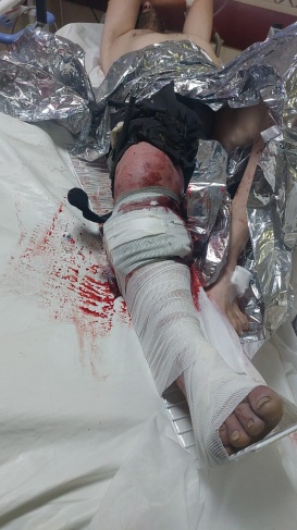 سلفيت : إصابة راعٍ برصاص الاحتلال في دير بلوط