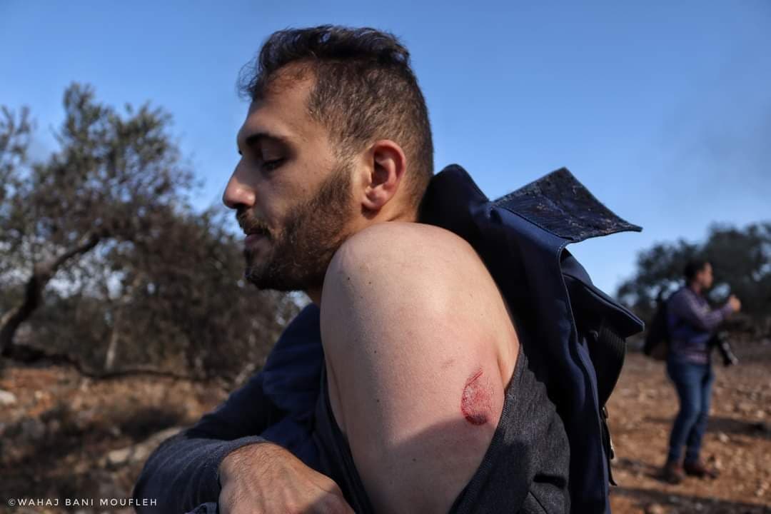 إصابة صحفي بـالمطاط وعشرات المواطنين بالاختناق خلال مواجهات مع الاحتلال في بيتا