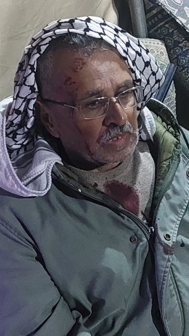 فلسطين – اصابة بهجوم مستوطنين شرق يطا