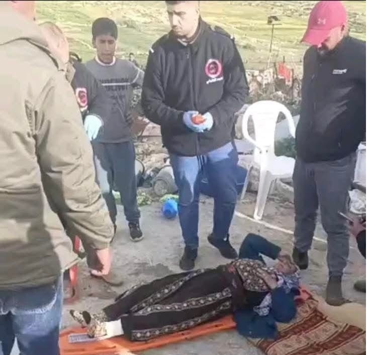 فلسطين – إصابة مسنة واعتقال مواطنين خلال اعتداء مستوطنين على خربة غوين في مسافر يطا