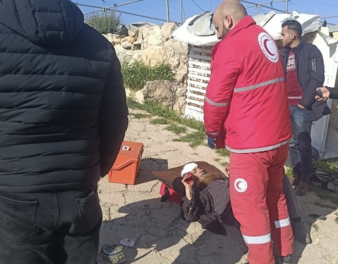 فلسطين – إصابتان واعتقال شاب في مسافر يطا جنوب الخليل